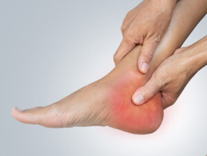 plantar fasciitis plantar fascia embolization