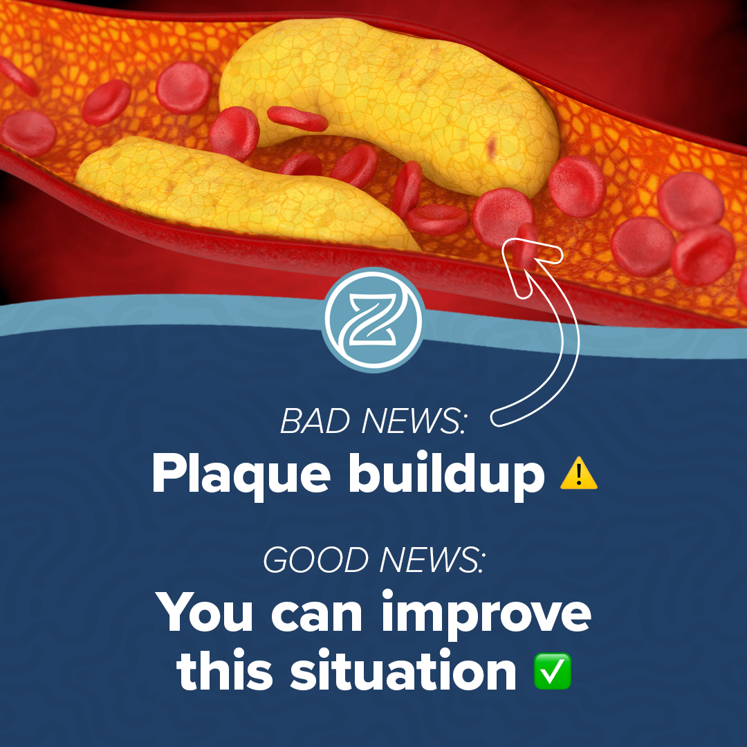 Bad news plaque buildup good news you can improve this situation