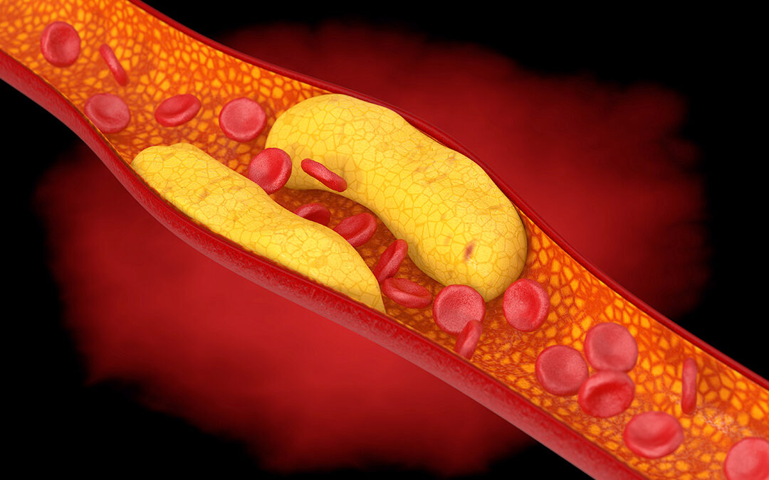 How Carbs Affect Your Vascular Health